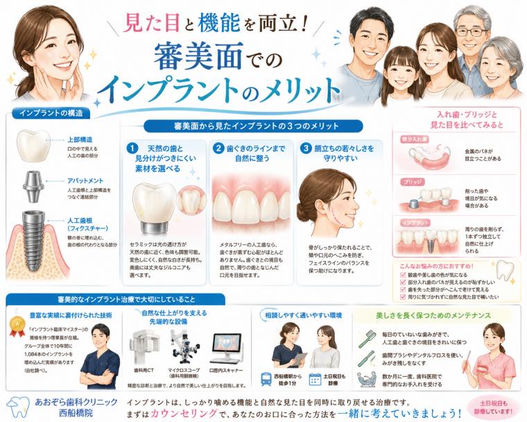 見た目と機能を両立！審美面でのインプラントのメリット
